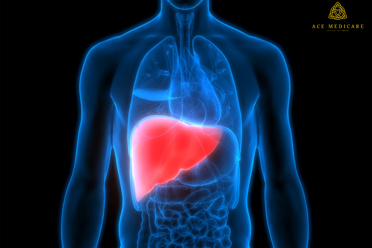 Preventing Fatty Liver: Tips for a Liver-Healthy Lifestyle